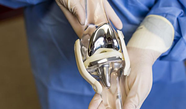 جراحی تعویض مفصل زانو چیست