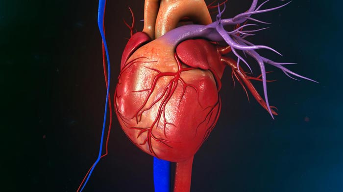 گرفتگی رگ قلب - گرفتگی عروق قلب - درمان گرفتگی رگ های قلب