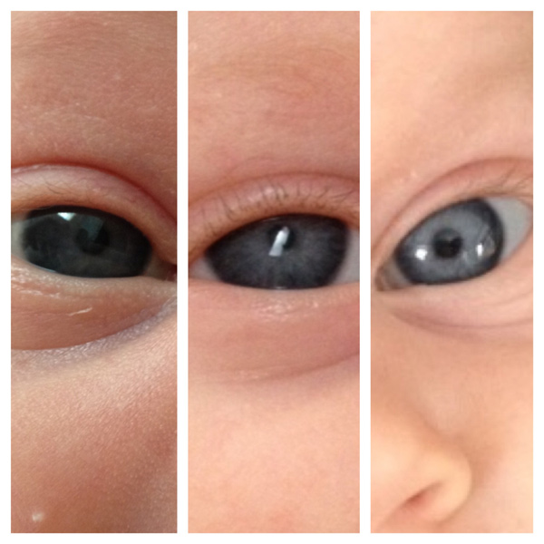 تغییرات رنگ چشم نوزاد 