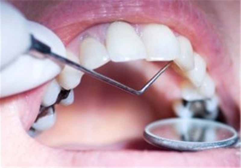  روش ترمیم دندان‌های پوسیده
