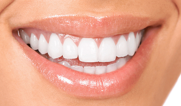 کامپوزیت دندان چیست؟ 