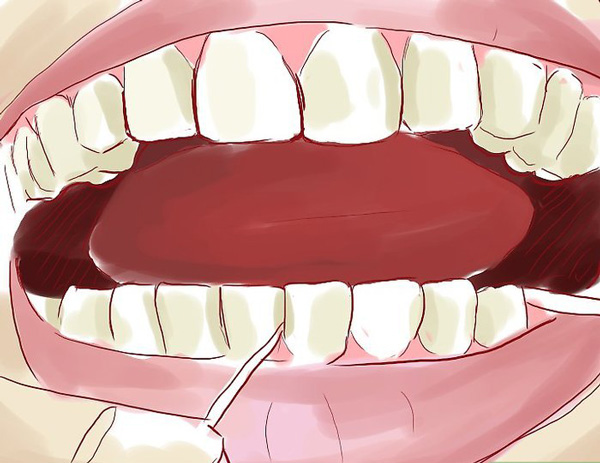 روش صحیح نخ دندان کشیدن میان دندان و خط لثه