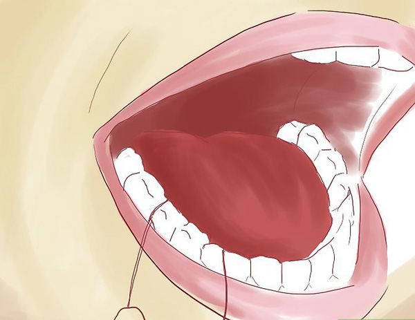 روش صحیح نخ دندان کشیدن و رفع مشکل خونریزی لثه