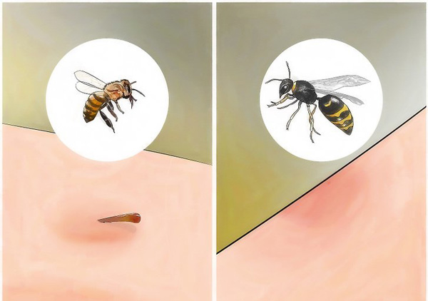 نحوه ی تشخیص نیش زنبور