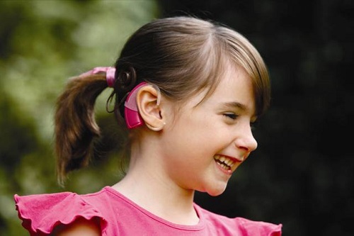 کاشت حلزون گوش در کودکان و بزرگسالان برای بهبود شنوایی