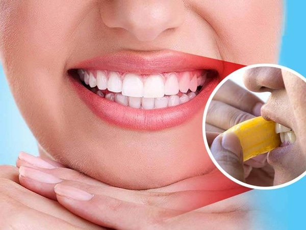 جرم گیری دندان با پوست موز