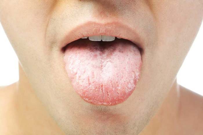 علت تلخی دهان در صبح چیست؟