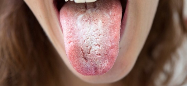 خواص گل گاو زبان (درمان برفک دهان)