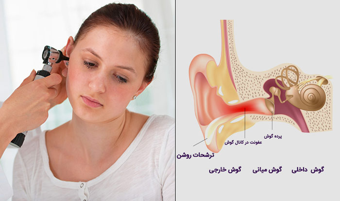 راه های درمان التهاب گوش 