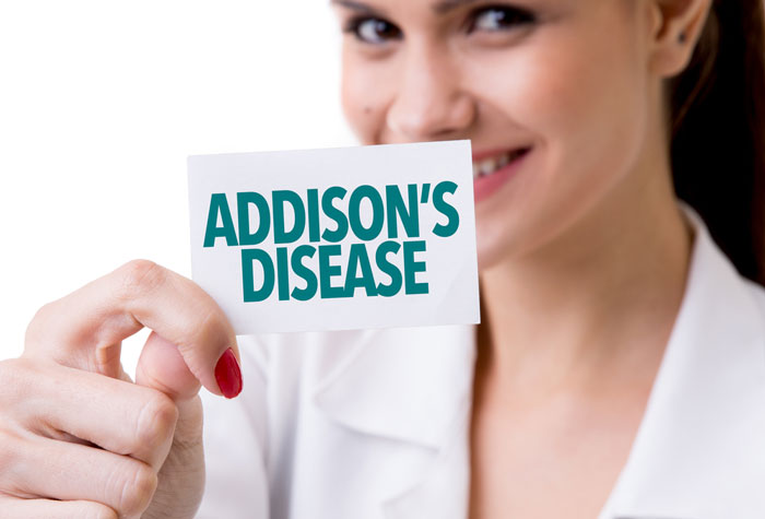 بیماری آدیسون یا نارسایی غدد فوق کلیوی