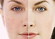 برای حفظ سلامت پوست چه کارهایی باید انجام دهیم؟