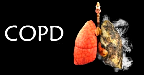 COPD؛‌ شایع‌ترین بیماری در افراد سیگاری