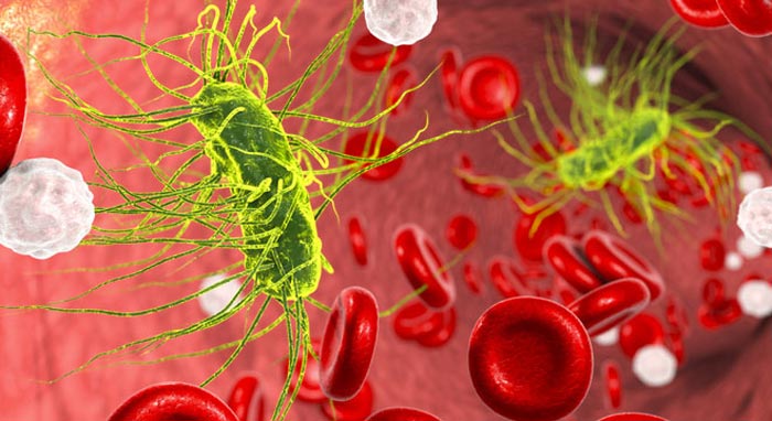 عفونت خون (سپسیس) چیست؟ + علائم و راه های درمان عفونت خون