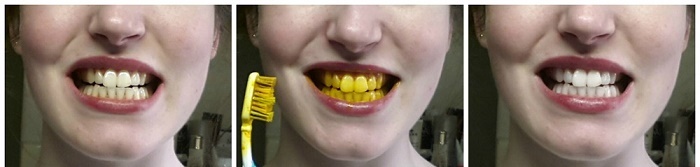 سفید کردن دندان با زردچوبه