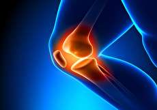 عمل آرتروپلاستی چیست و چگونه انجام میشود؟
