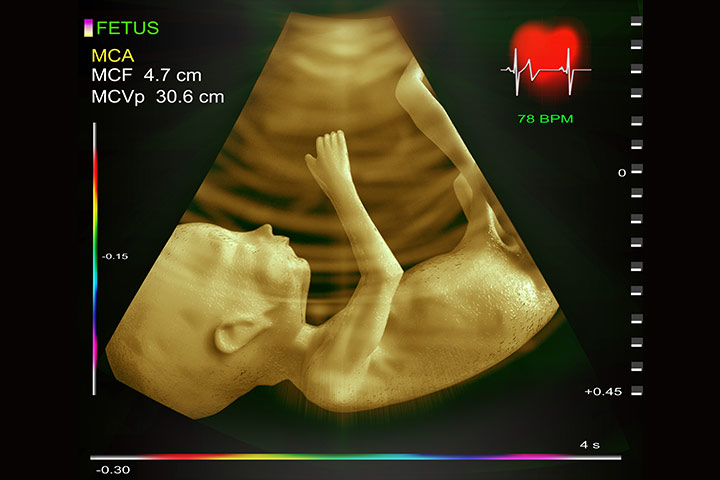 اکوی قلب جنین، راهی برای تشخیص نقایص قلبی مادرزادی