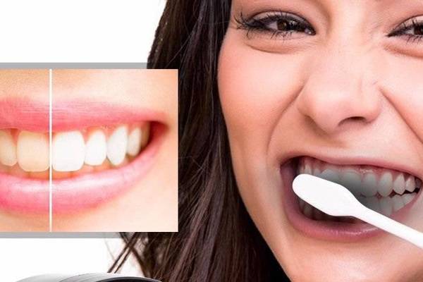 سفید کردن دندان با زغال