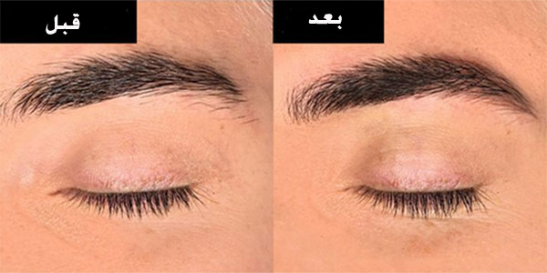 برداشتن ابرو برداشتن ابرو