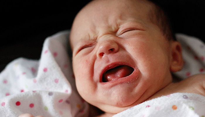 علائم بیش فعالی در نوزادان، گریه بیش از حد نوزاد را جدی بگیرید