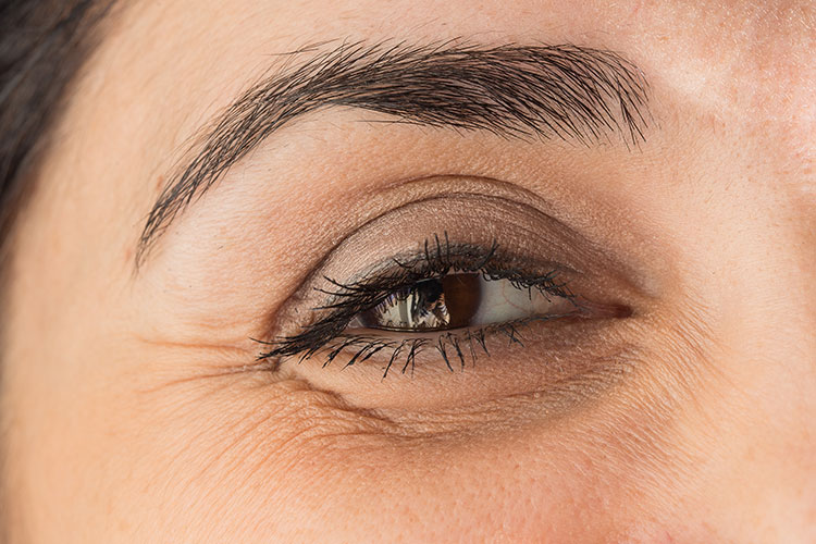درمان افتادگی پلک چشم
