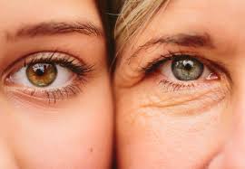 درمان افتادگی پلک چشم با روغن زیتون