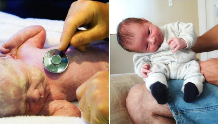 شلی عضلات در نوزادان، نشانه ها، دلایل و راه‌های درمان