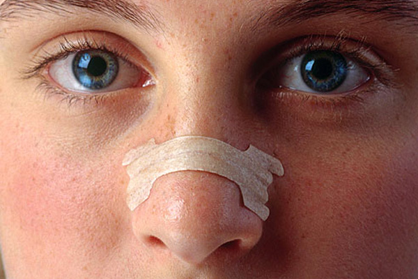 انحراف بینی در نوزادان و کودکان، نشانه‌ها و راه‌های درمان