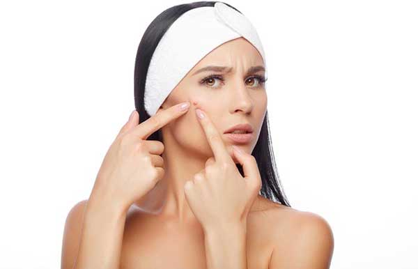 یکی از خواص روغن کرچک برای پوست بهبود آکنه‌ها و جوش‌های صورت است.