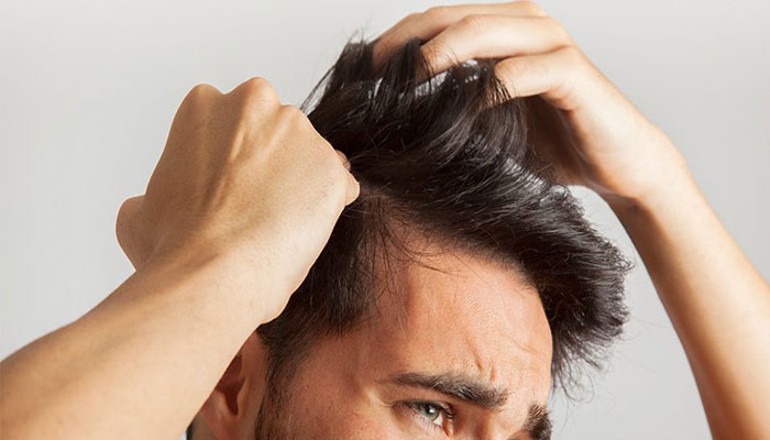 جلوگیری از ریزش مو در آقایان جلوگیری از ریزش مو در آقایان