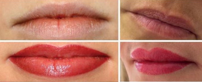 میکروپیگمنتیشن لب میکروپیگمنتیشن لب