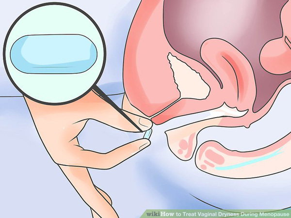 قرص برای درمان خشکی واژن