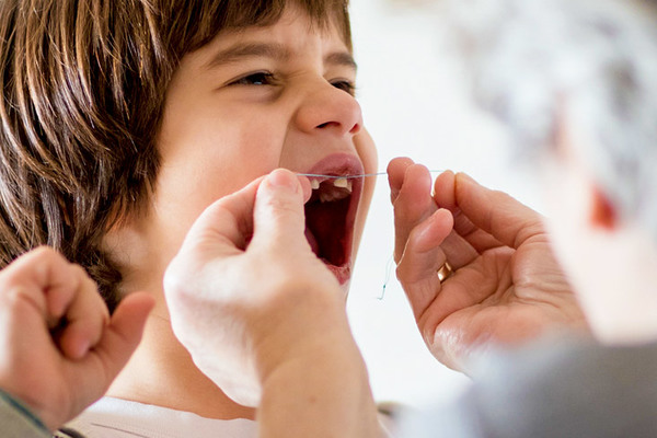 درمان آبسه دندان شیری کودکان و روش های پیشگیری از آن