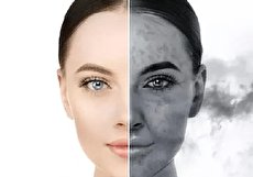۵ نکته مهم برای مراقبت از پوست در برابر آلودگی هوا