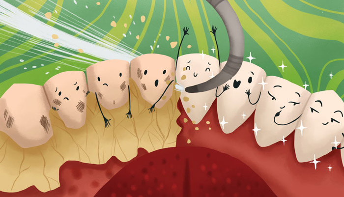 چگونه می‌توان جرم پشت دندان‌های جلو را از بین بر د؟