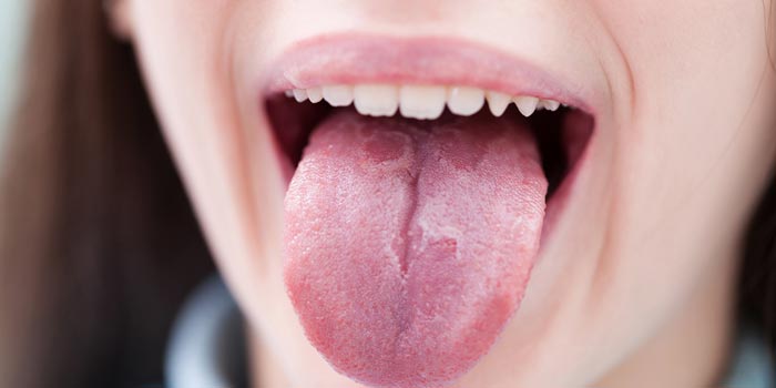 علائم سرطان زبان را بشناسید