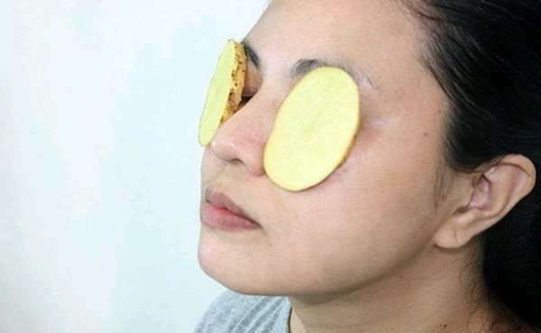 درمان برق زدگی چشم با سیب زمینی
