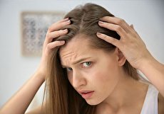 ارتباط رنگ مو و ریزش مو چقدر صحت دارد؟