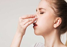راه های جلوگیری از خون دماغ شدن و نحوه بند آوردن آن