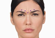 از بین بردن خط اخم با ۱۱ روش طبیعی و خانگی