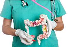 علائم کولیت روده (کولیت اولسراتیو) چیست؟