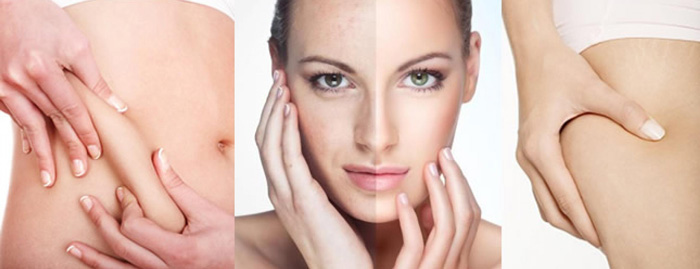 مزوتراپی برای لاغری موضعی؛ روش انجام، نتایج و هزینه ها مزوتراپی برای لاغری موضعی