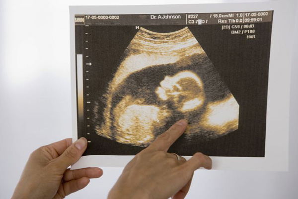 نتایج تفسیر سونوگرافی بارداری
