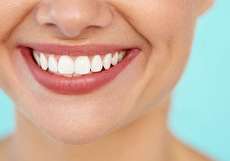 تزریق ژل خط خنده؛ نحوه تزریق، عوارض و مراقبتهای لازم