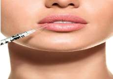 فیلر لب چیست و چگونه انجام میشود؟