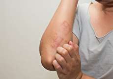 علائم حساسیت به گلوتن چیست و چگونه تشخیص داده میشود؟