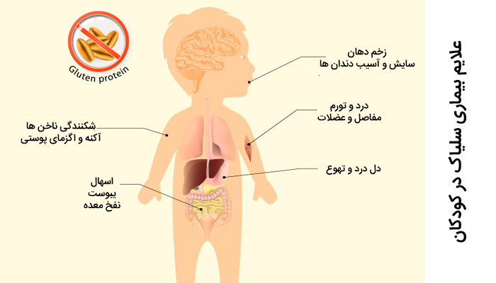 علایم بیماری سلیاک در نوزادان و کودکان