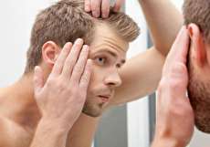 قرص فولیکوژن چقدر در درمان ریزش مو موثر است؟