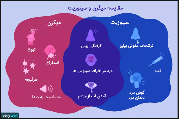 فرق سردرد میگرنی با سینوزیت