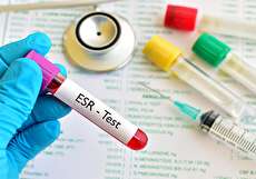 تست ESR آزمایش خون؛ علت تجویز، تفسیر و عوامل موثر بر نتیجه
