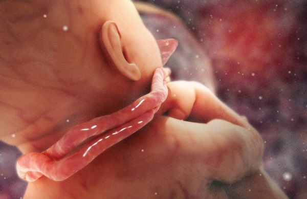افزایش مایع دور جنین؛ تغییر میزان مایع دور جنین چه خطراتی را به دنبال دارد؟